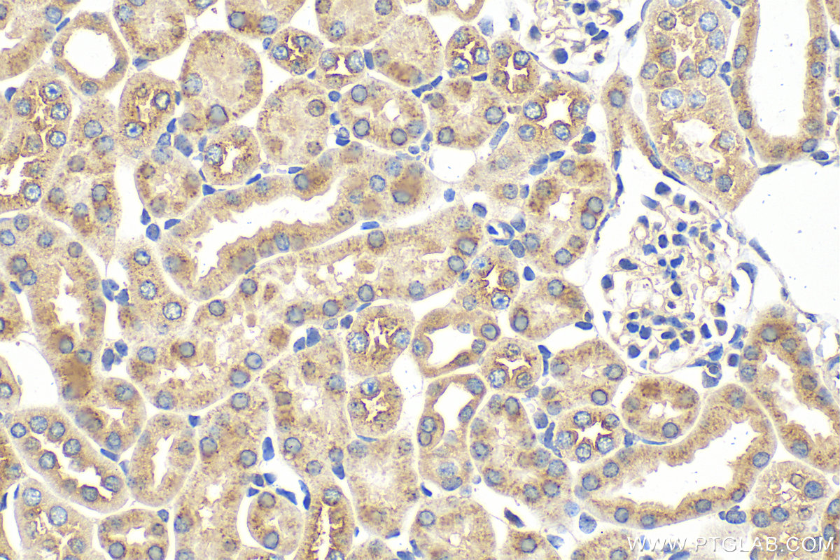 IHC staining of mouse kidney using 28653-1-AP (same clone as 28653-1-PBS)