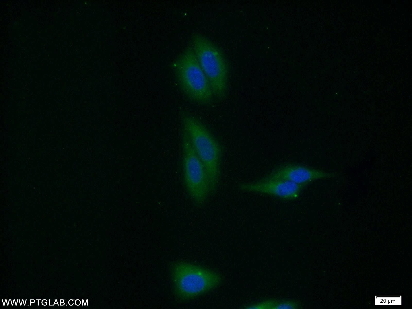 IF Staining of HepG2 using 10236-1-AP