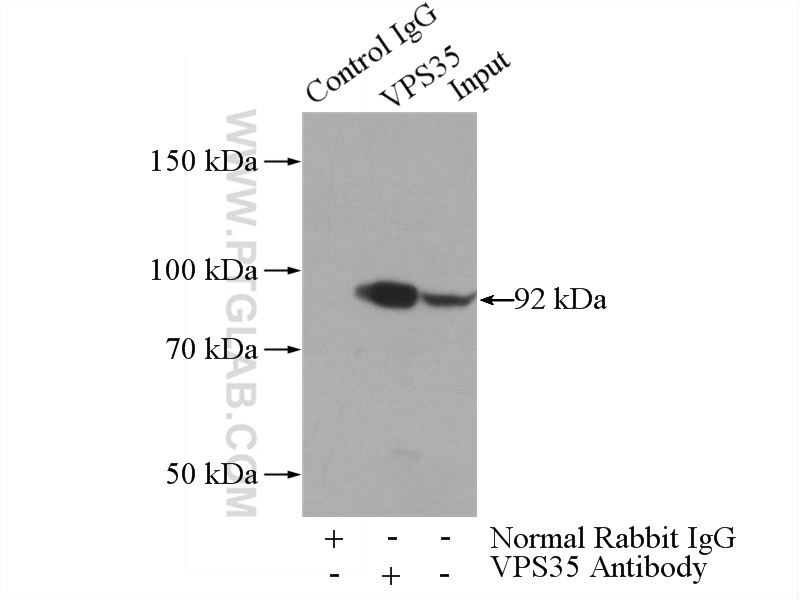 IP experiment of mouse kidney using 10236-1-AP