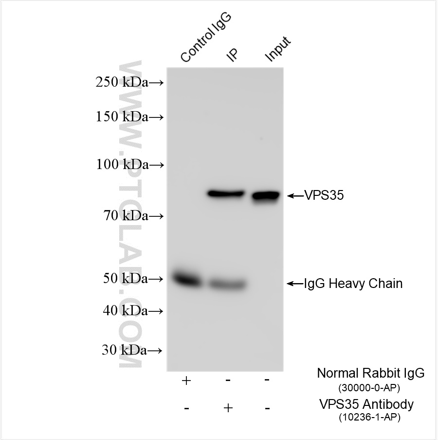 IP experiment of HEK-293 using 10236-1-AP
