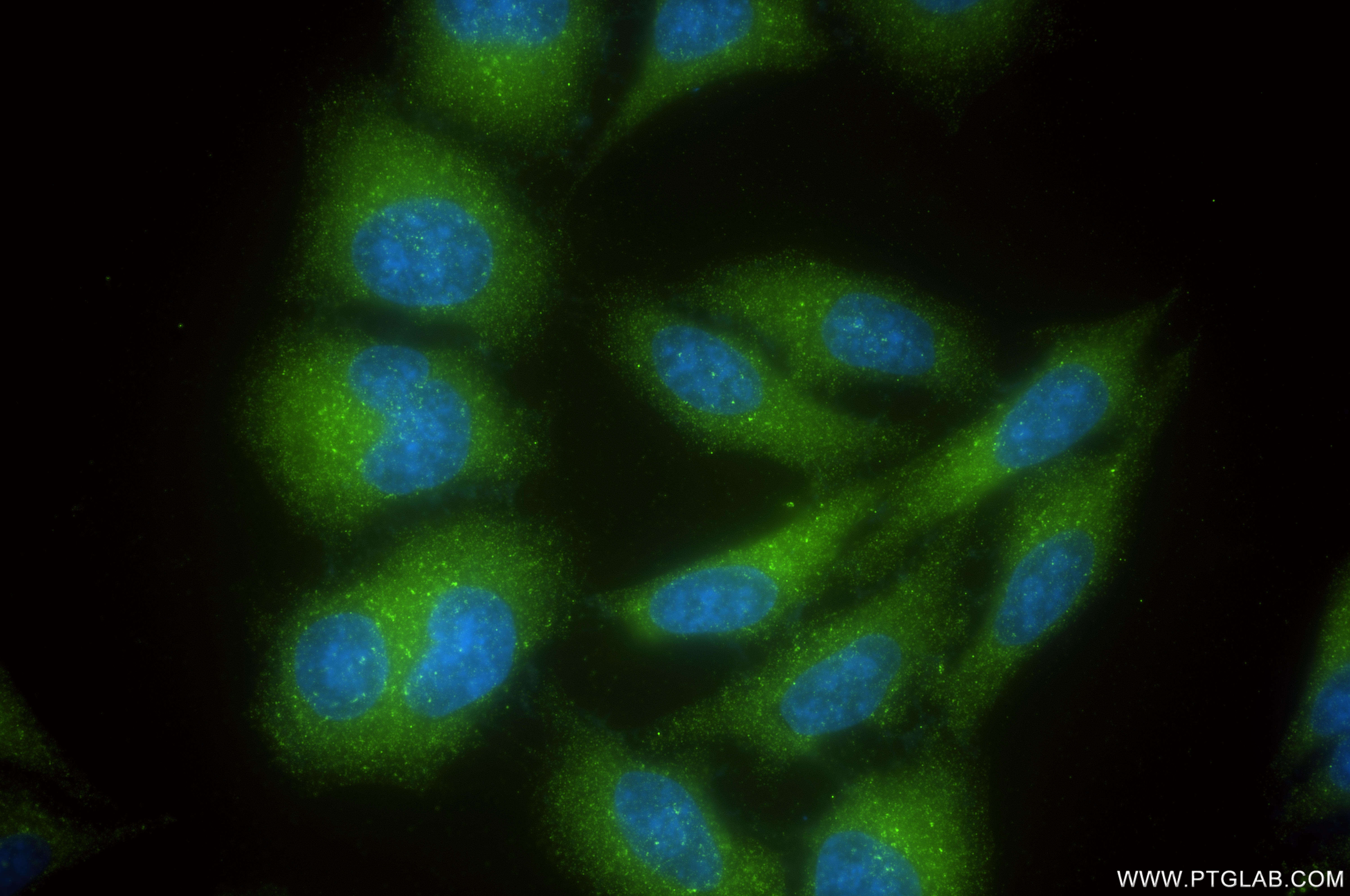 Immunofluorescent analysis of (-20°C Ethanol) fixed HepG2 cells using VPS35 antibody (83328-2-RR, Clone: 250521F1 ) at dilution of 1:200 and CoraLite®488-Conjugated Goat Anti-Rabbit IgG(H+L) (<a class='green' href='/productredirect?CatalogNo=SA00013-2' target='_blank'>SA00013-2</a>). IF Staining of HepG2 using 83328-2-RR