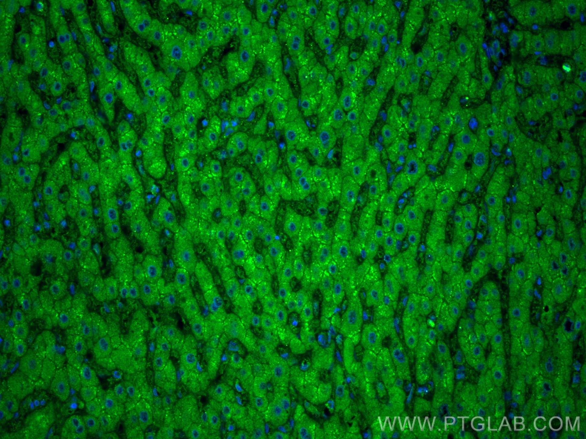 IF Staining of human liver using 11870-1-AP