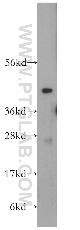 WB analysis of human liver using 11870-1-AP