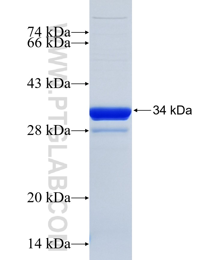 VPS37D fusion protein Ag24930 SDS-PAGE VPS37D fusion protein Ag24930 SDS-PAGE
