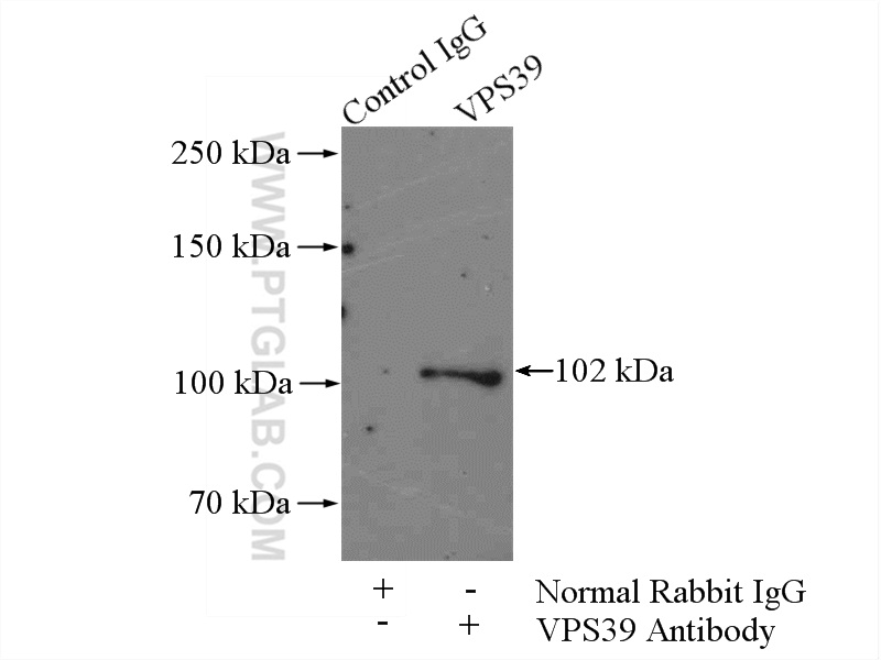 IP experiment of mouse brain using 16219-1-AP