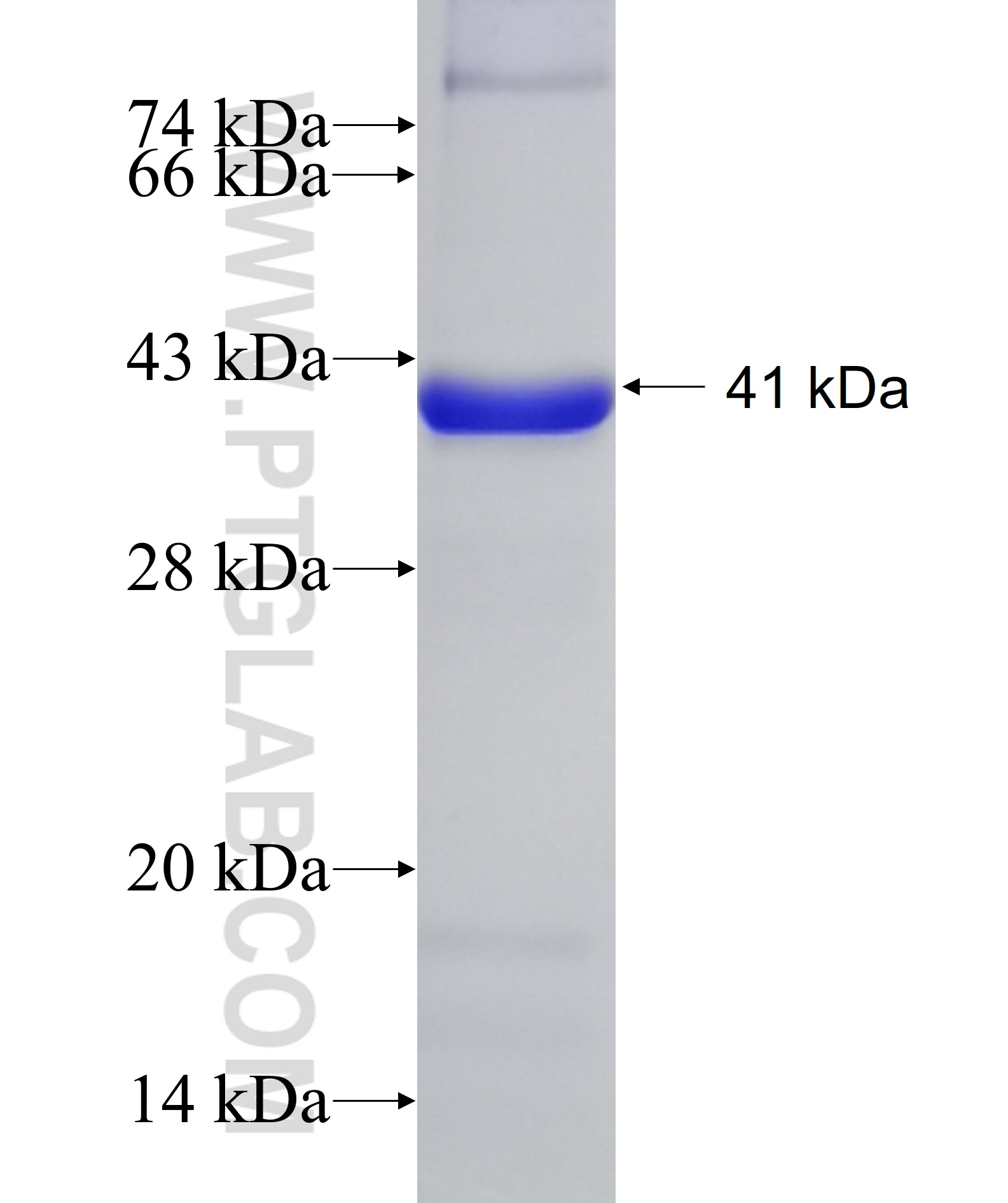 VPS41 fusion protein Ag5001 SDS-PAGE