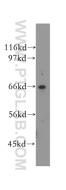 VPS45 Polyclonal antibody