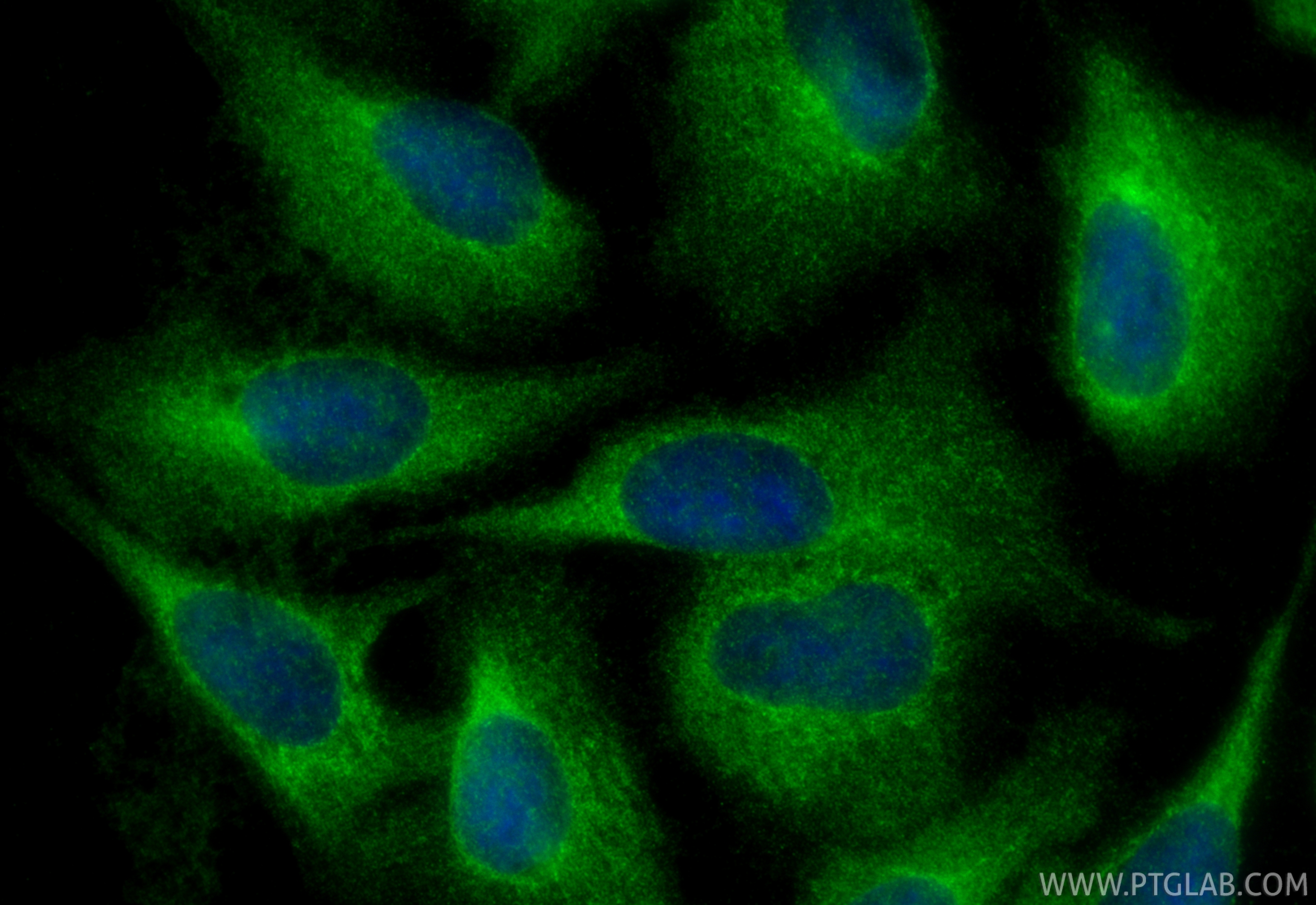 IF Staining of U2OS using 14272-1-AP