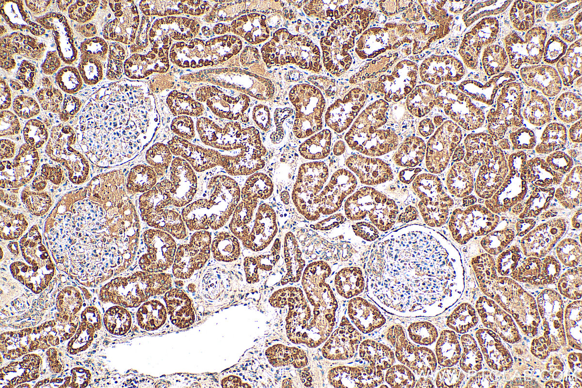 IHC staining of human kidney using 14272-1-AP