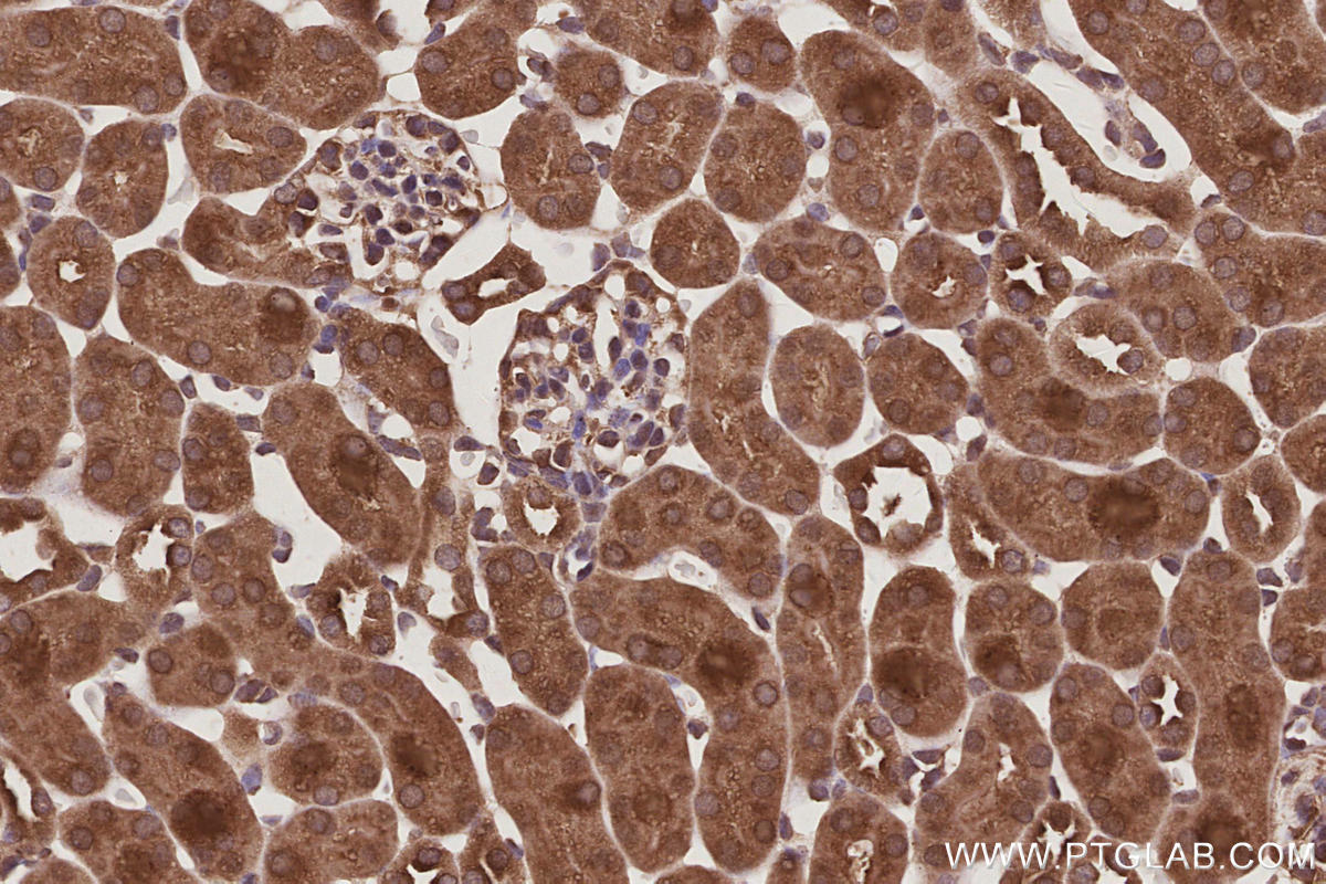 IHC staining of mouse kidney using 14272-1-AP IHC staining of mouse kidney using 14272-1-AP