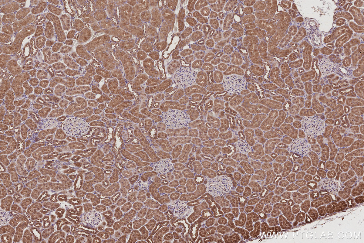 IHC staining of rat kidney using 14272-1-AP IHC staining of rat kidney using 14272-1-AP