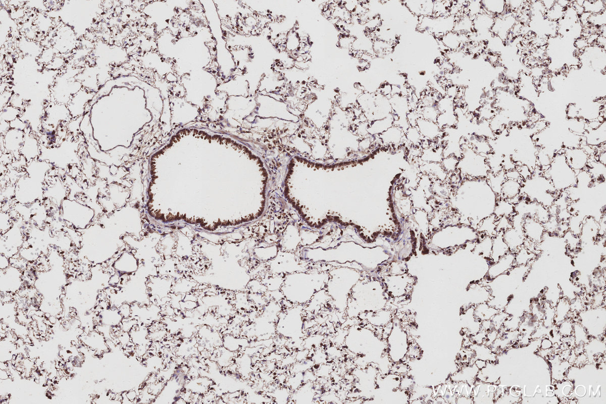 IHC staining of rat lung using 14272-1-AP IHC staining of rat lung using 14272-1-AP