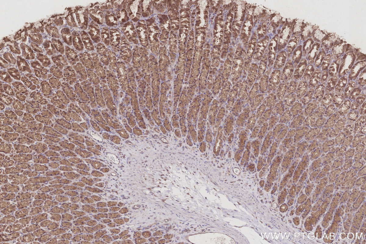 IHC staining of rat stomach using 14272-1-AP IHC staining of rat stomach using 14272-1-AP