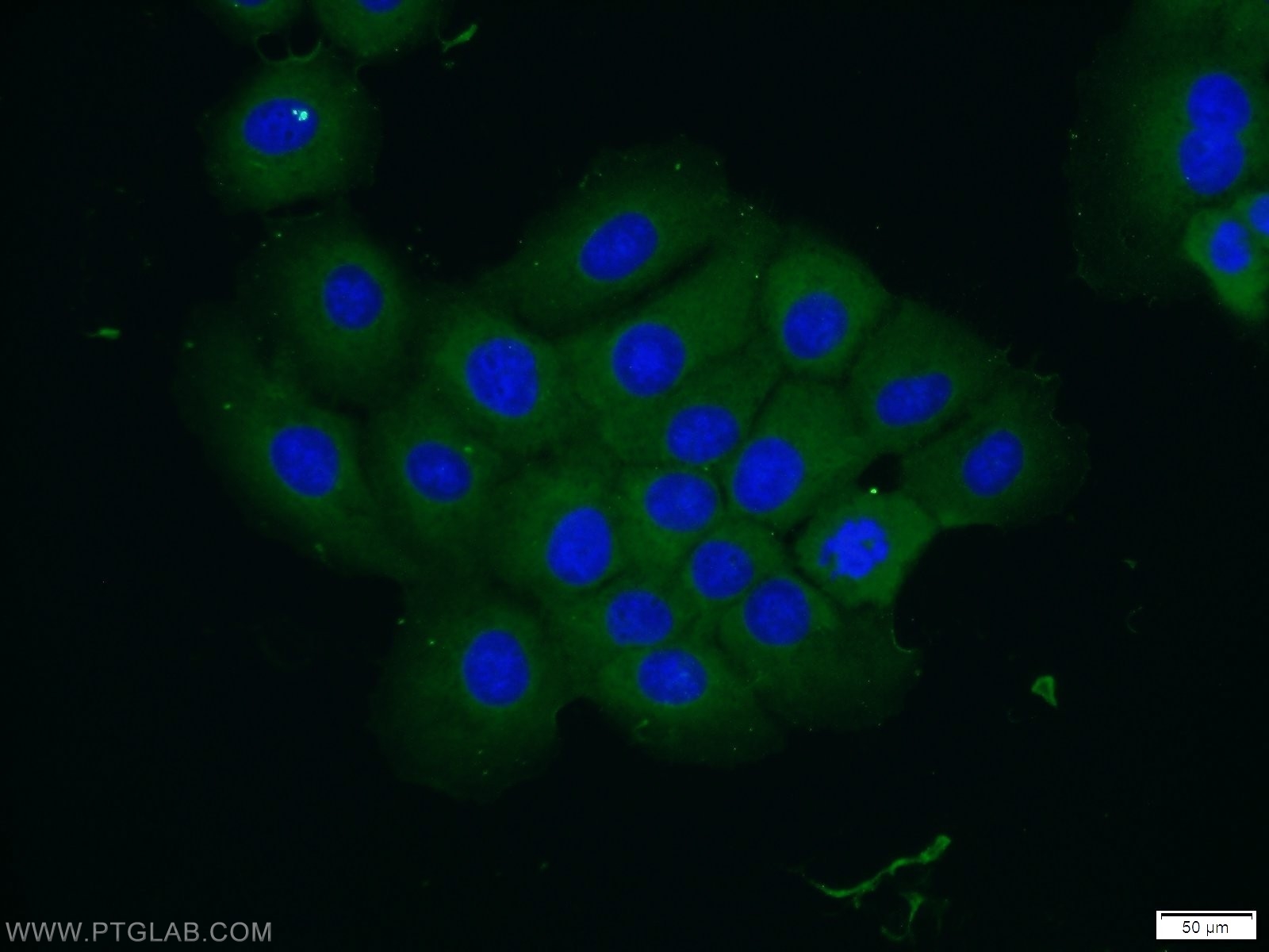 IF Staining of A431 using 17673-1-AP