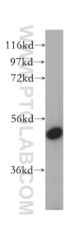 VPS4A/B Polyclonal antibody