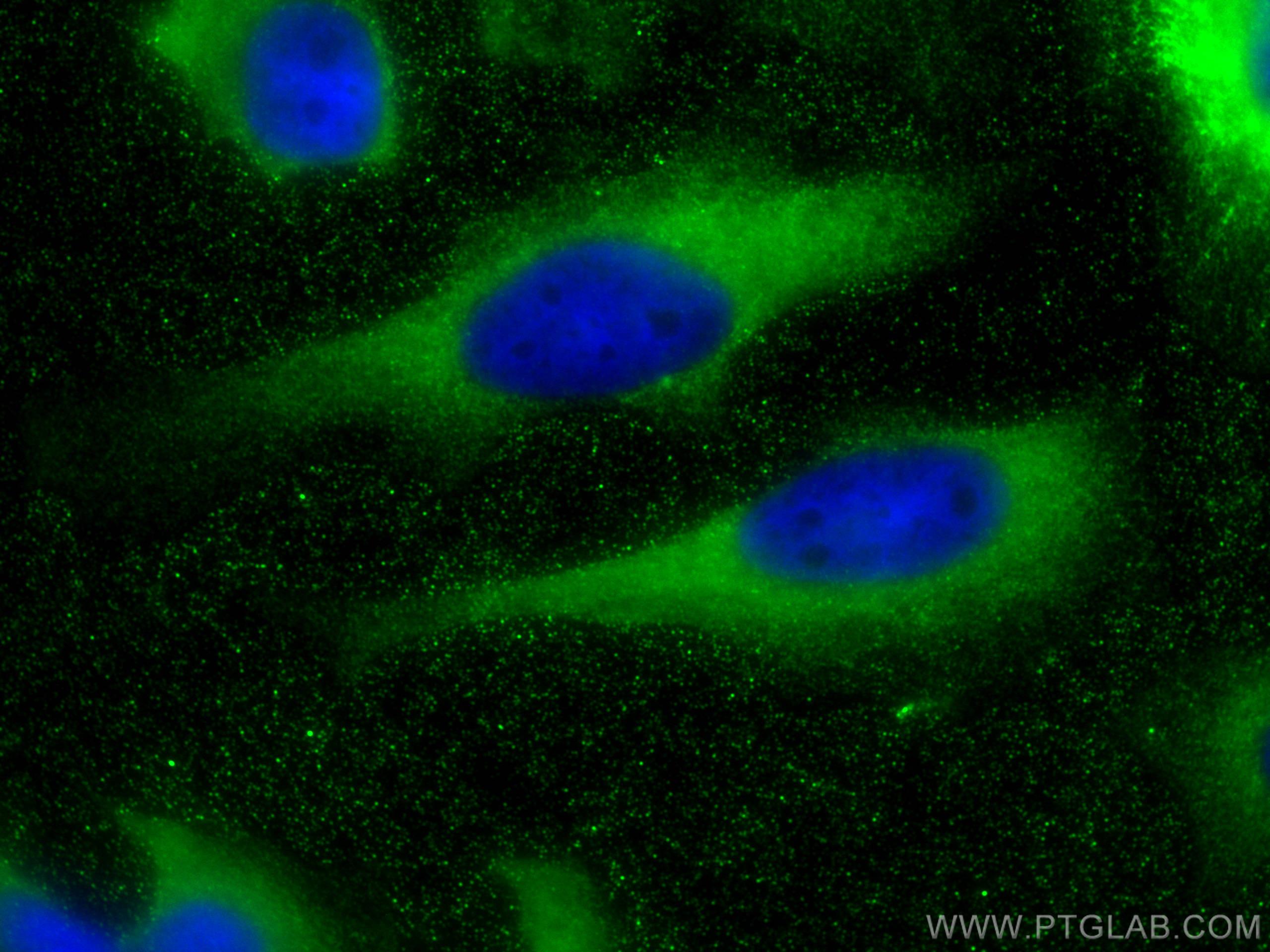 IF Staining of HeLa using 68443-1-Ig