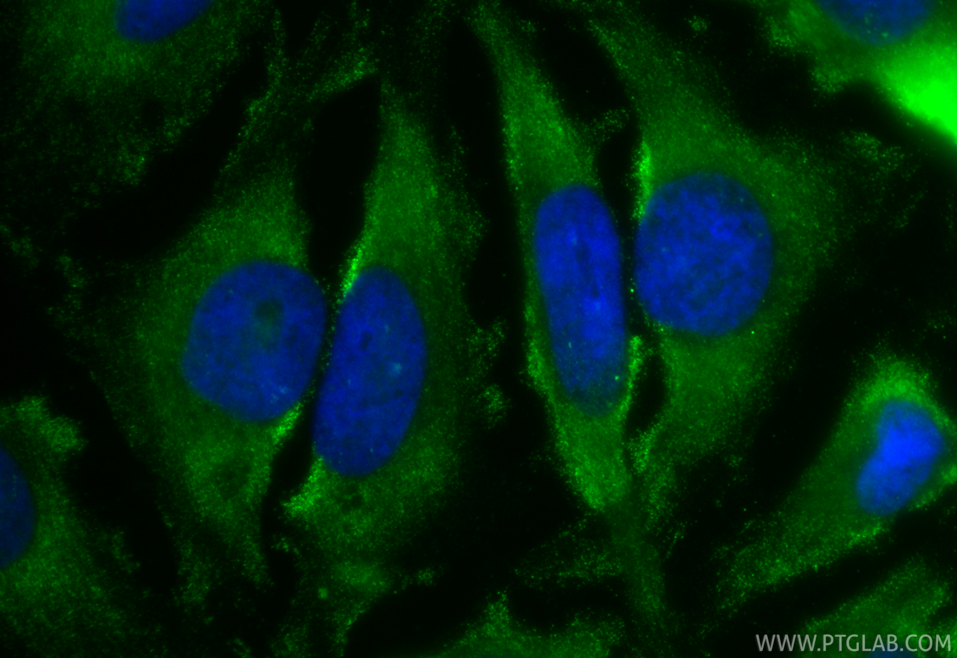 IF Staining of HeLa using CL488-68443