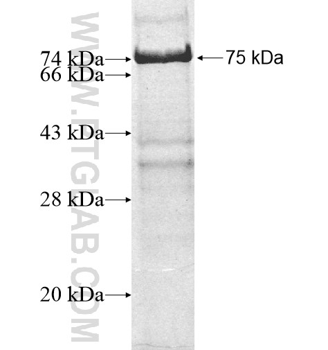 VPS4B fusion protein Ag11583 SDS-PAGE VPS4B fusion protein Ag11583 SDS-PAGE