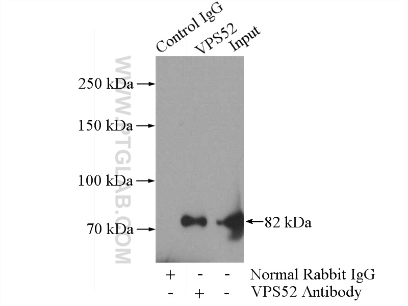 IP experiment of mouse skin using 11662-2-AP