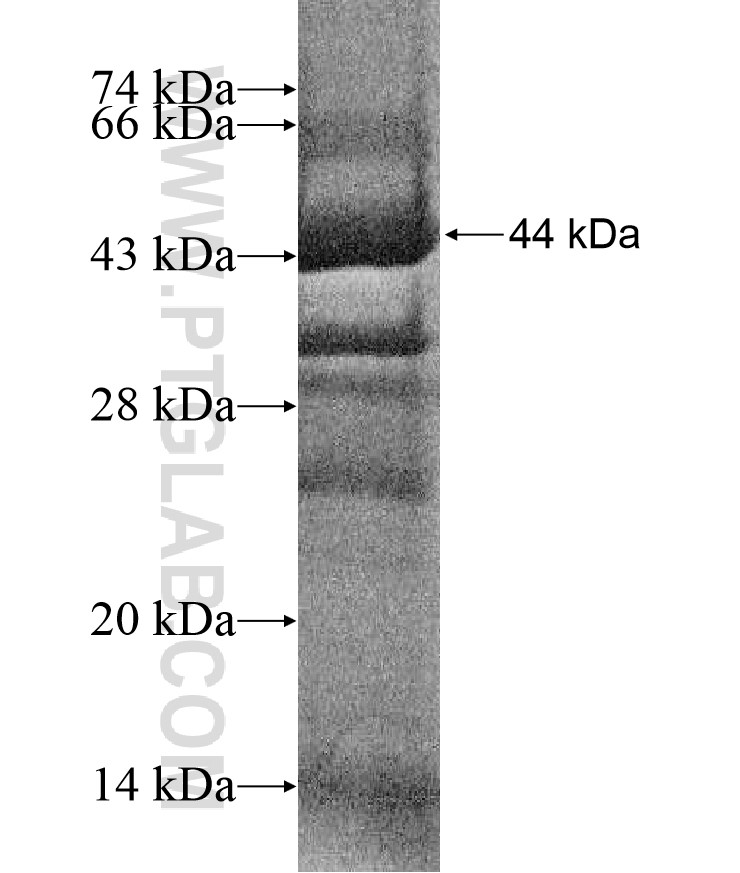 VPS52 fusion protein Ag17611 SDS-PAGE VPS52 fusion protein Ag17611 SDS-PAGE