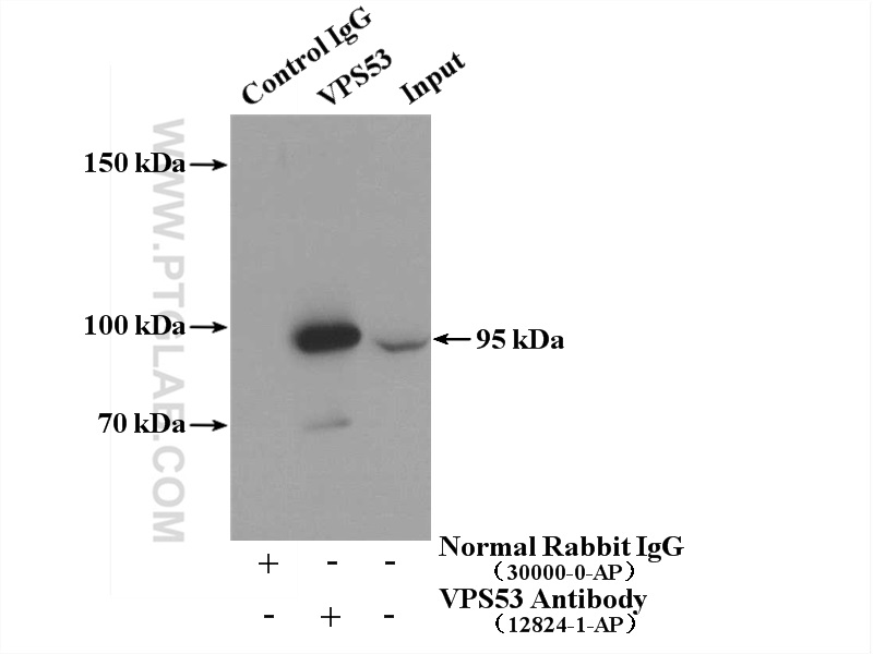 IP experiment of mouse liver using 12824-1-AP