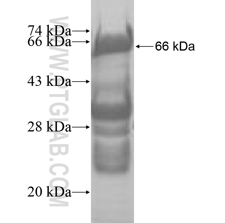 VPS72 fusion protein Ag7420 SDS-PAGE VPS72 fusion protein Ag7420 SDS-PAGE