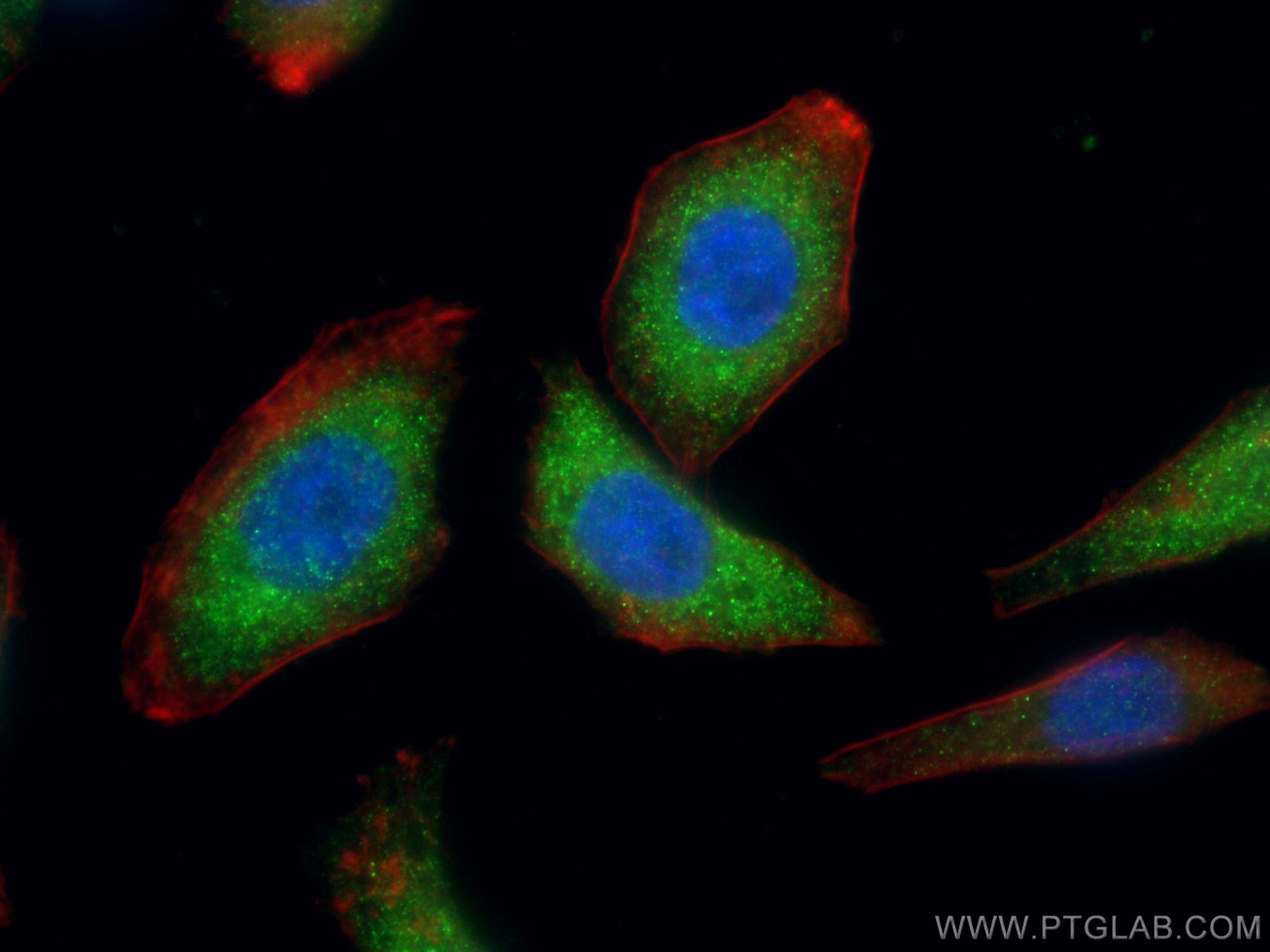 IF Staining of HepG2 using 15079-1-AP