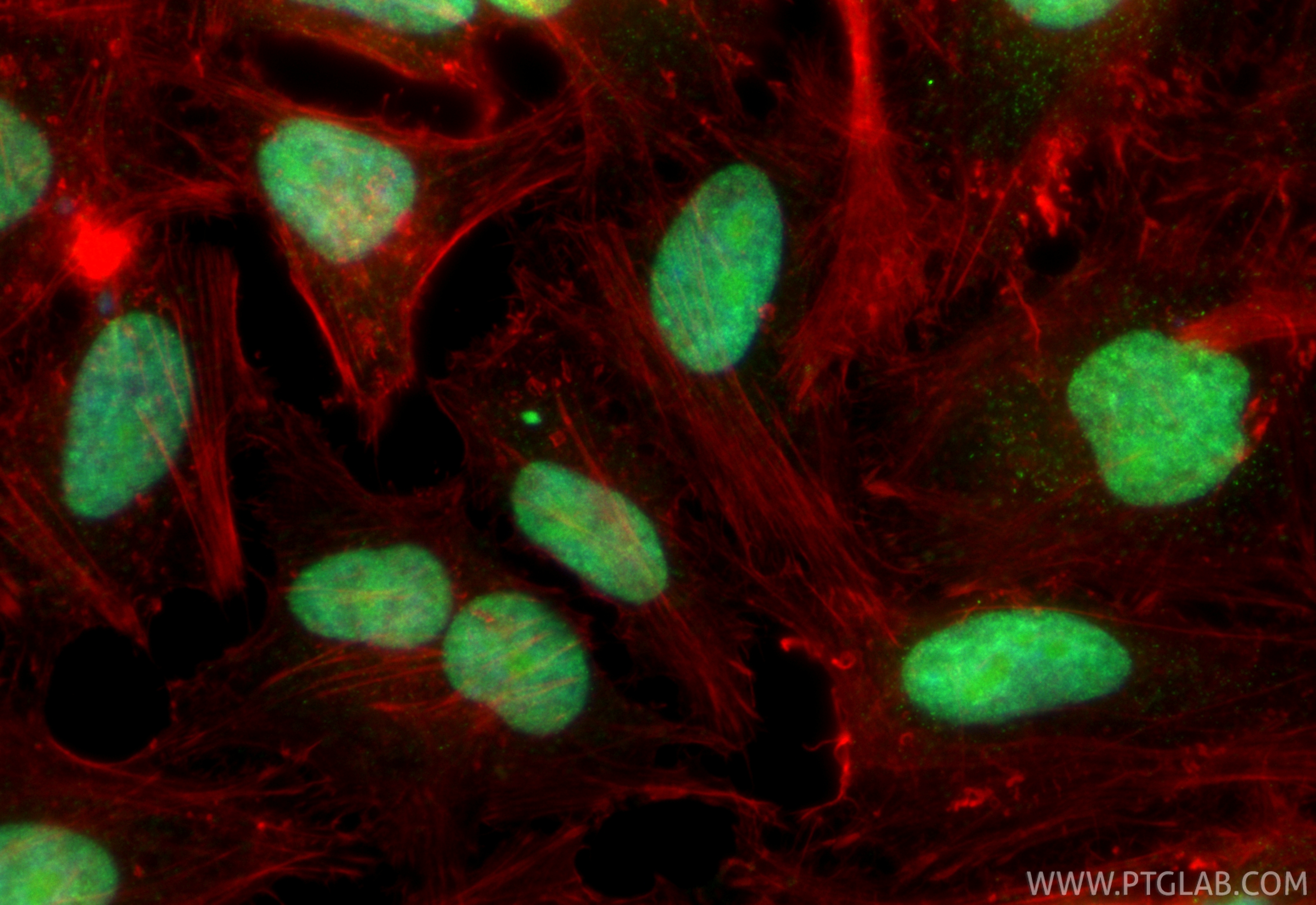Immunofluorescent analysis of (4% PFA) fixed HeLa cells using CoraLite® Plus 488 VRK1 antibody (CL488-85598-2, Clone: 242978A1 ) at dilution of 1:200, CL594-Phalloidin (red). IF Staining of HeLa using CL488-85598-2