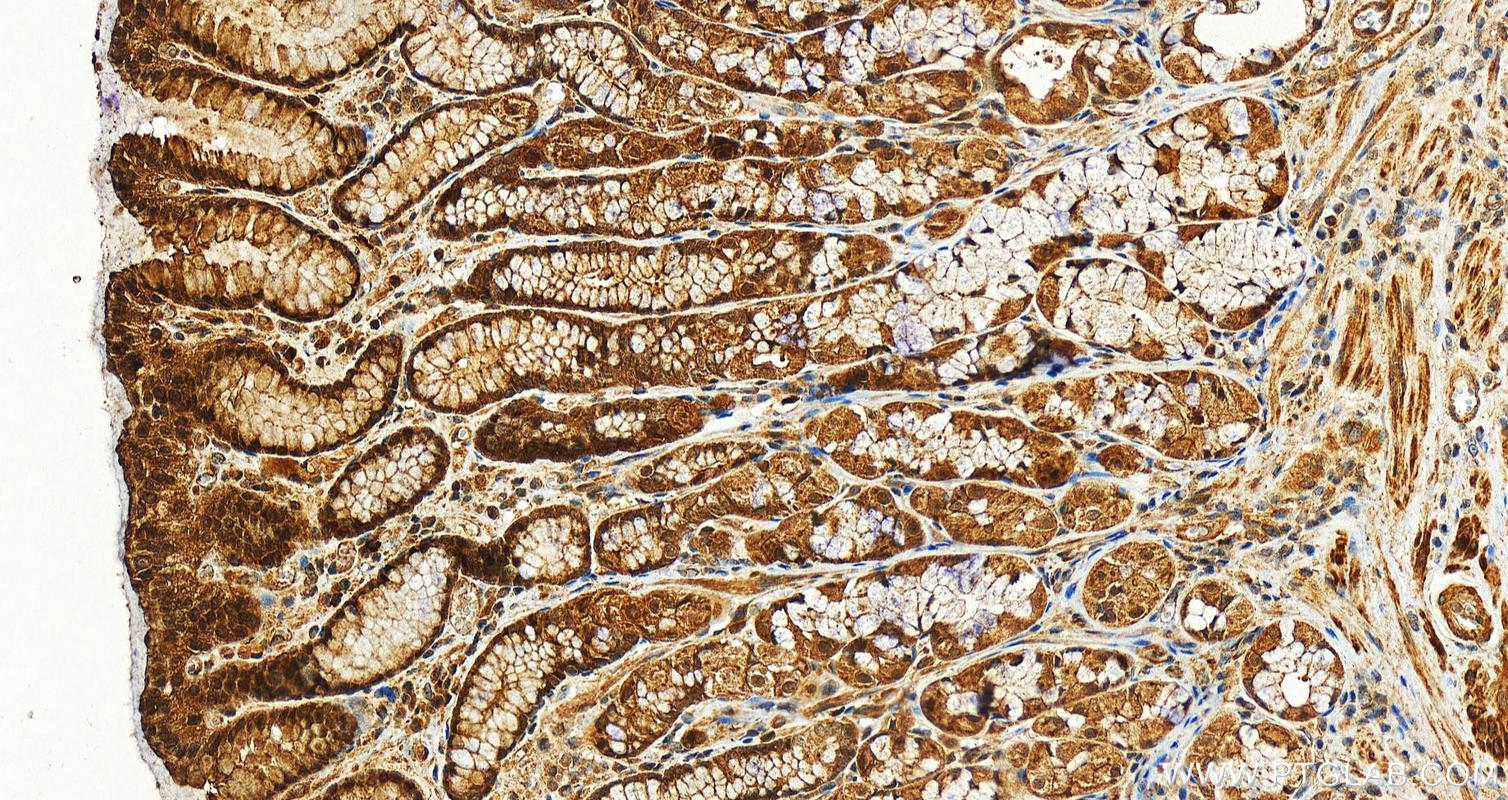 IHC staining of human stomach using 12946-1-AP