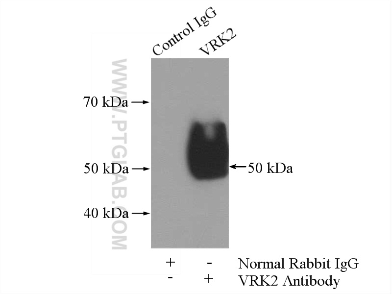 IP experiment of K-562 using 12946-1-AP