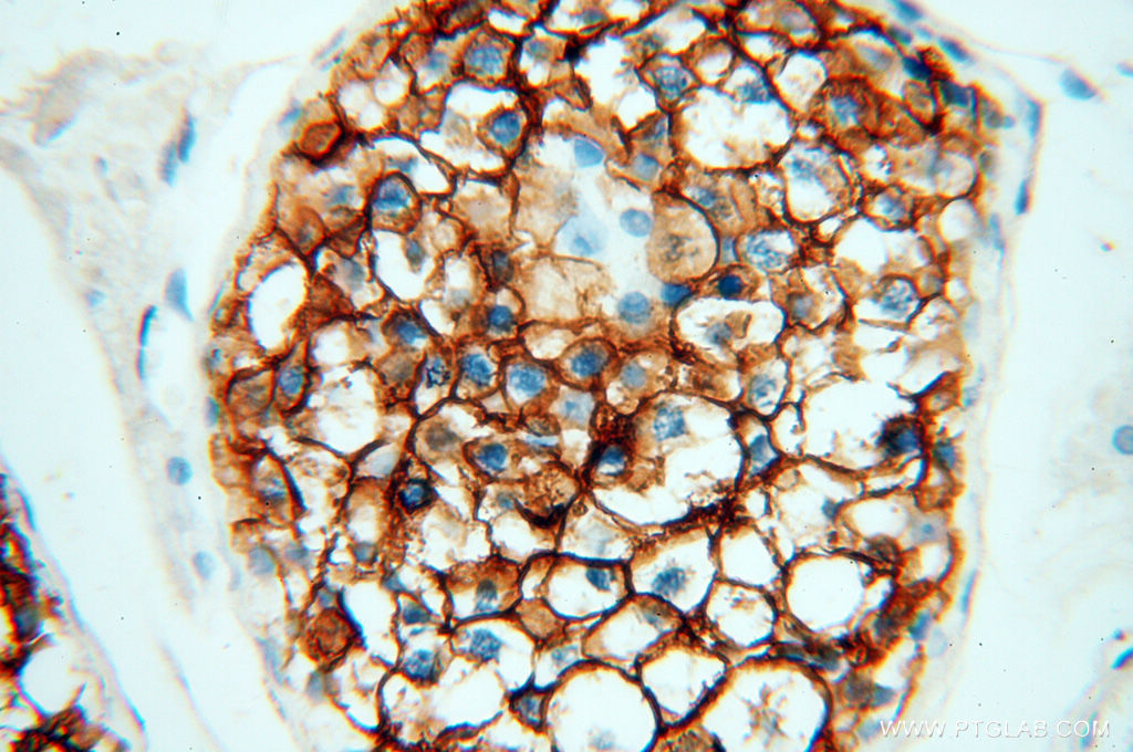 IHC staining of human testis using 14145-1-AP