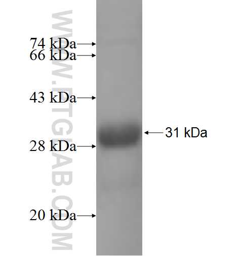 VSIG1 fusion protein Ag6625 SDS-PAGE VSIG1 fusion protein Ag6625 SDS-PAGE