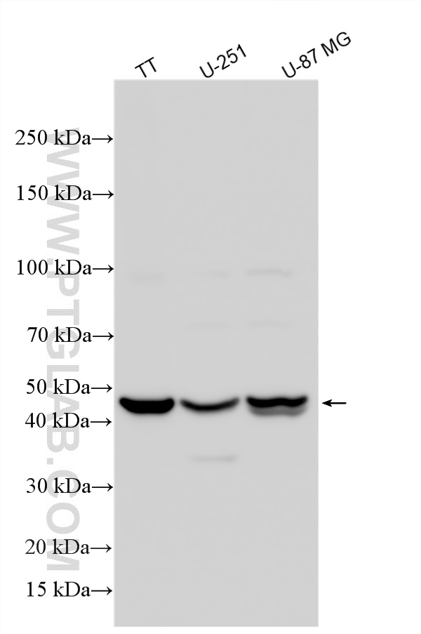 WB analysis using 27829-1-AP (same clone as 27829-1-PBS)