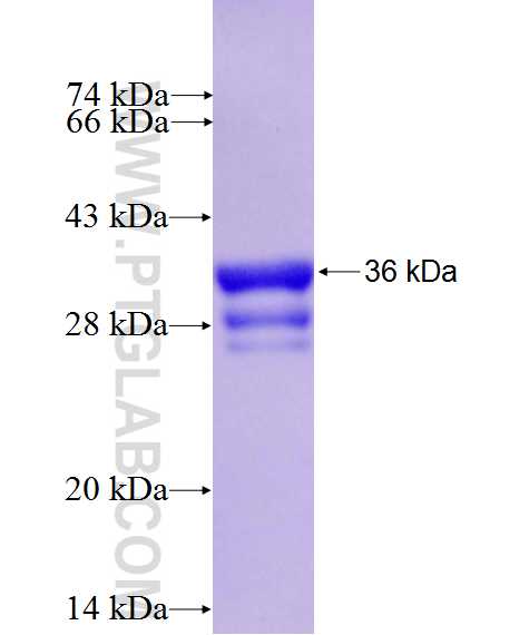 VSIG4 fusion protein Ag27214 SDS-PAGE VSIG4 fusion protein Ag27214 SDS-PAGE