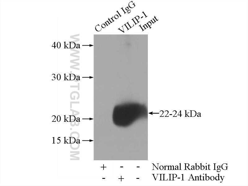 IP experiment of mouse brain using 13919-1-AP