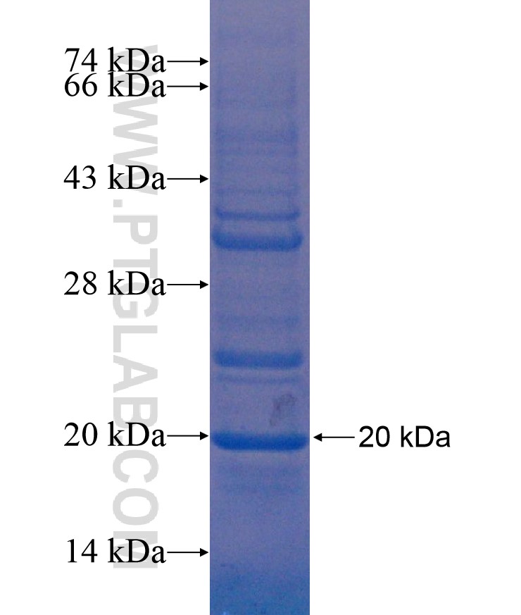 VSTM1 fusion protein Ag17182 SDS-PAGE VSTM1 fusion protein Ag17182 SDS-PAGE