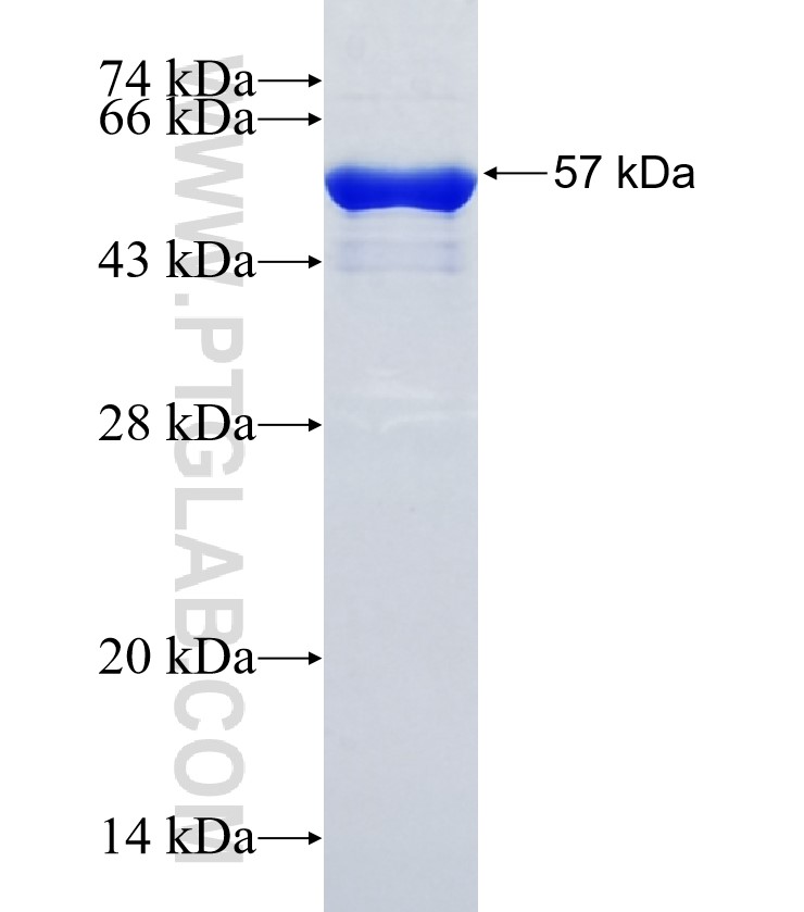VSTM2B fusion protein Ag35220 SDS-PAGE