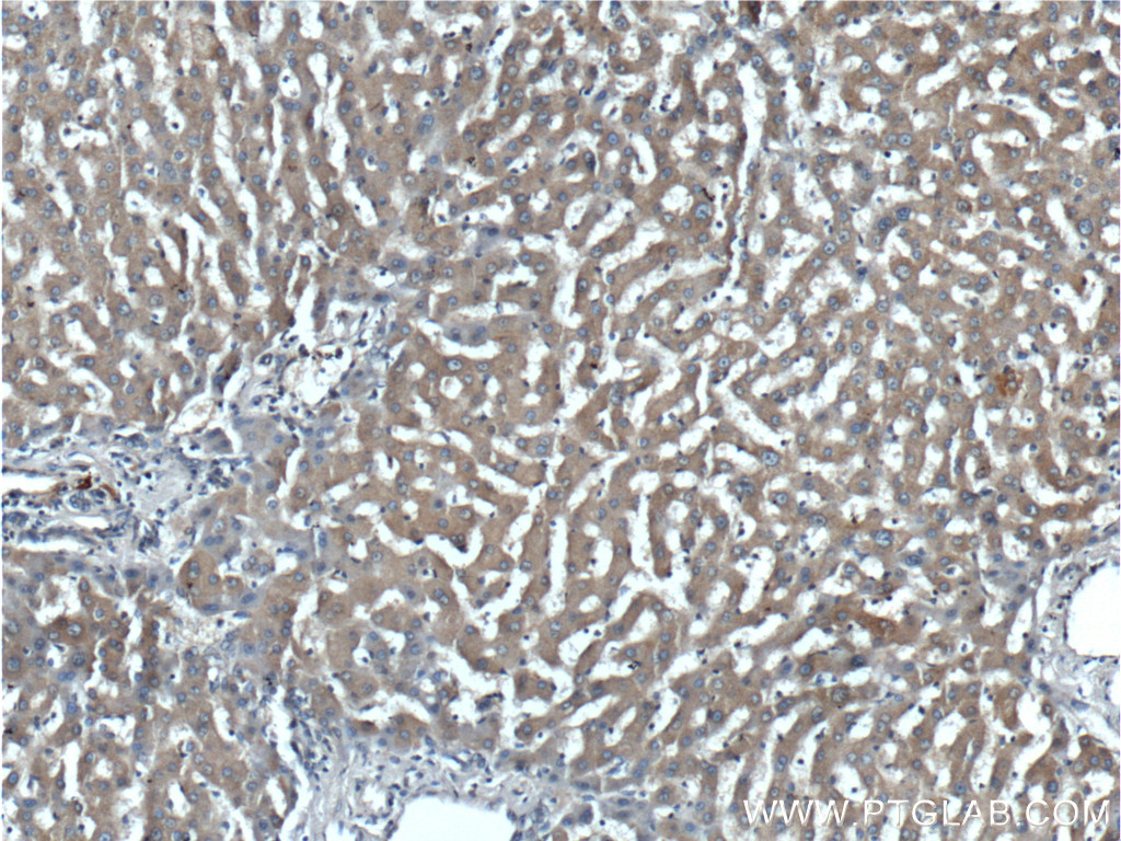 IHC staining of human liver using 25457-1-AP