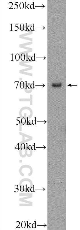 WB analysis of mouse eye using 23566-1-AP