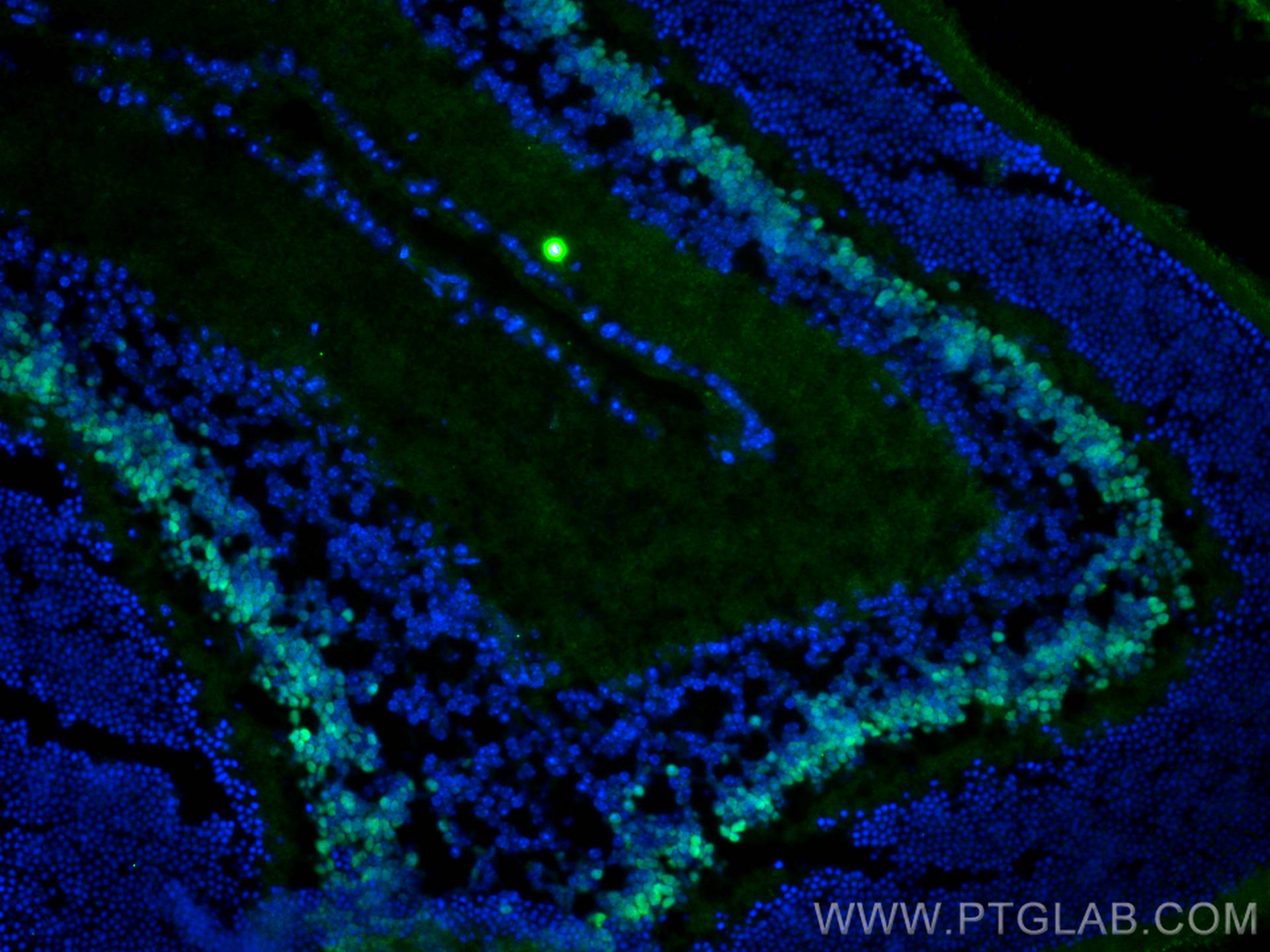 IF Staining of mouse eye using 25825-1-AP