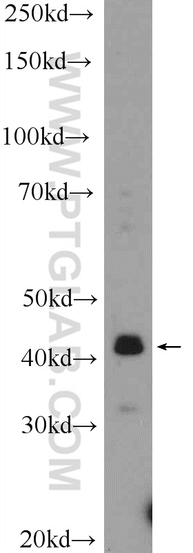 VSX2 Polyclonal antibody