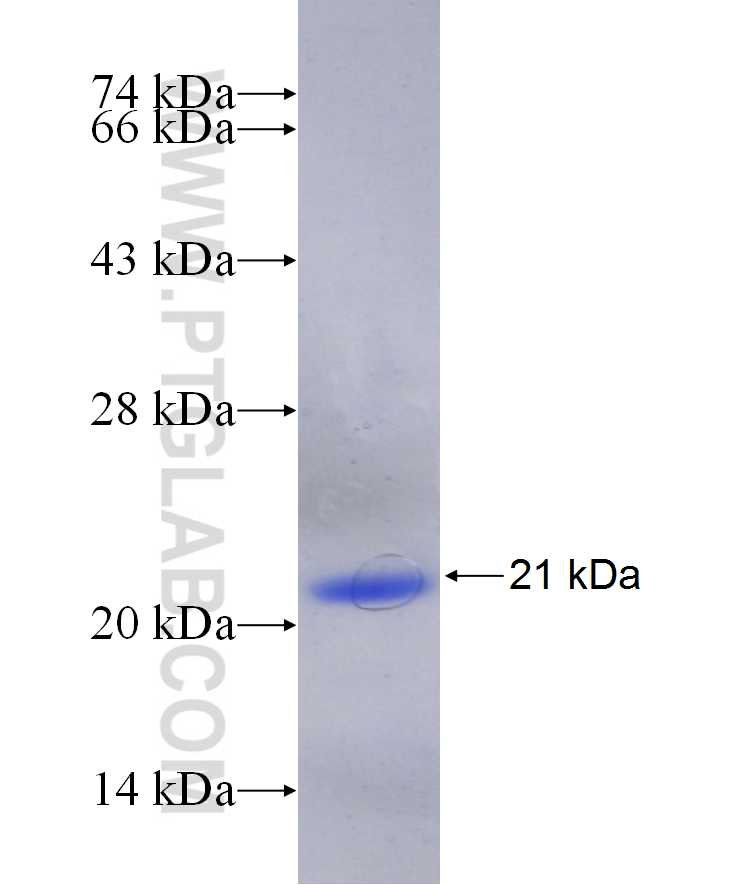 VSX2 fusion protein Ag29867 SDS-PAGE