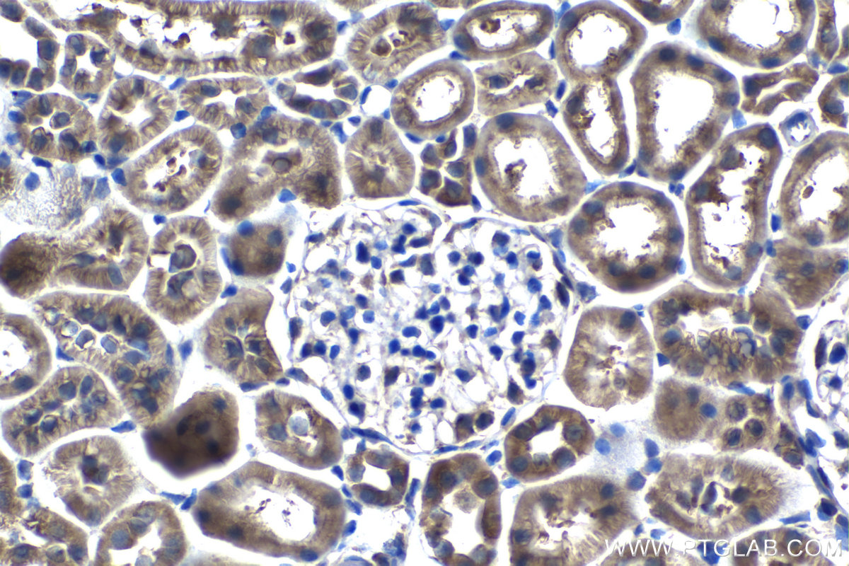 IHC staining of rat kidney using 66817-1-Ig