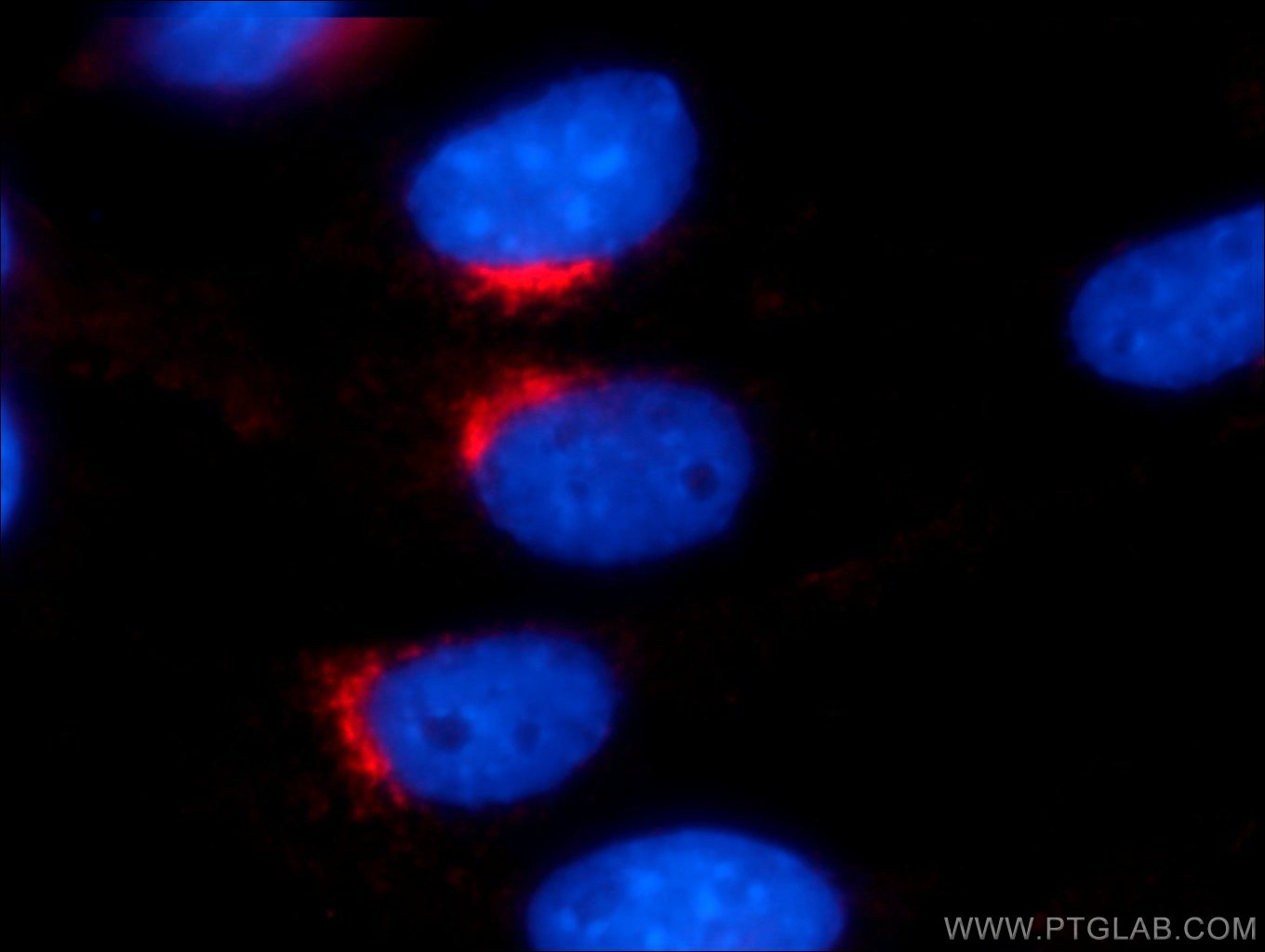 IF Staining of NIH/3T3 using 12354-1-AP