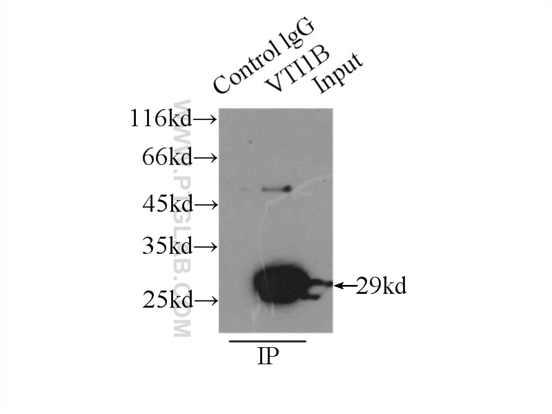 IP experiment of HeLa using 14495-1-AP