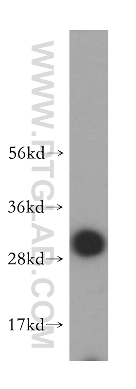 VTI1B Polyclonal antibody