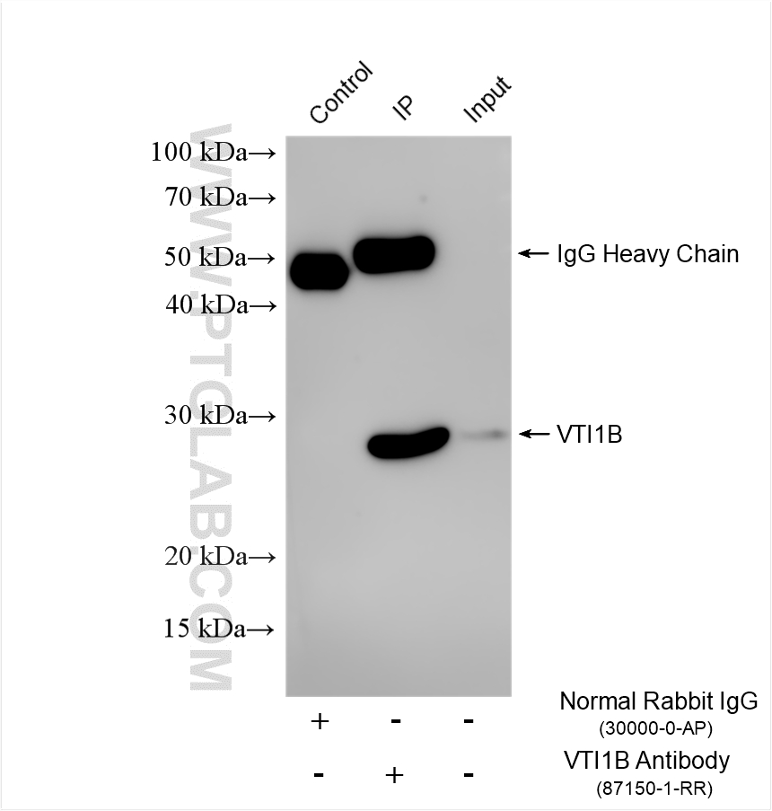 IP experiment of HeLa using 87150-1-RR (same clone as 87150-1-PBS)