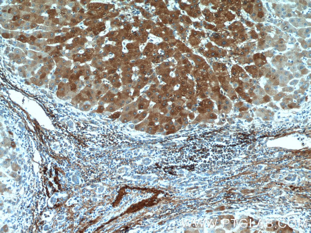 Vitronectin Polyclonal antibody