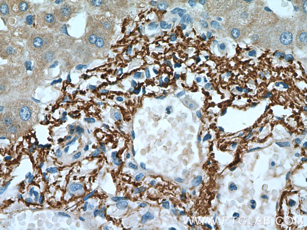 IHC staining of human liver using 15833-1-AP