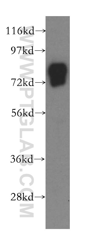 Vitronectin Polyclonal antibody